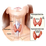 Thyroid Surgery In Dubai