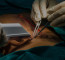 Hernia Treatment In Dubai