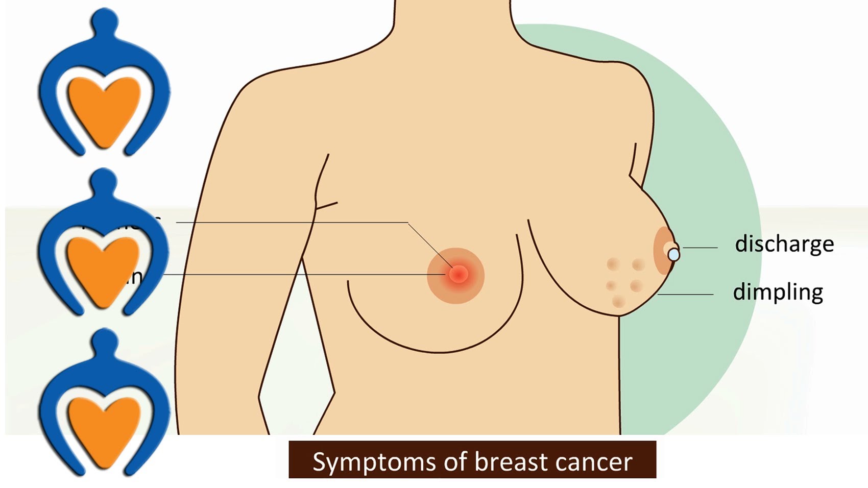 Breast Screening in dubai