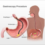 Gastroscopy And Associated Procedures In Dubai