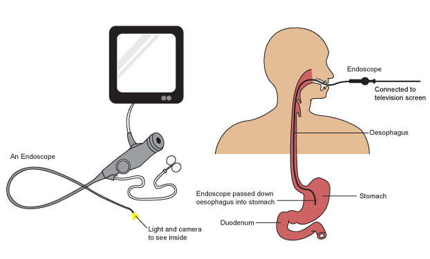 Gastroscopy In Dubai