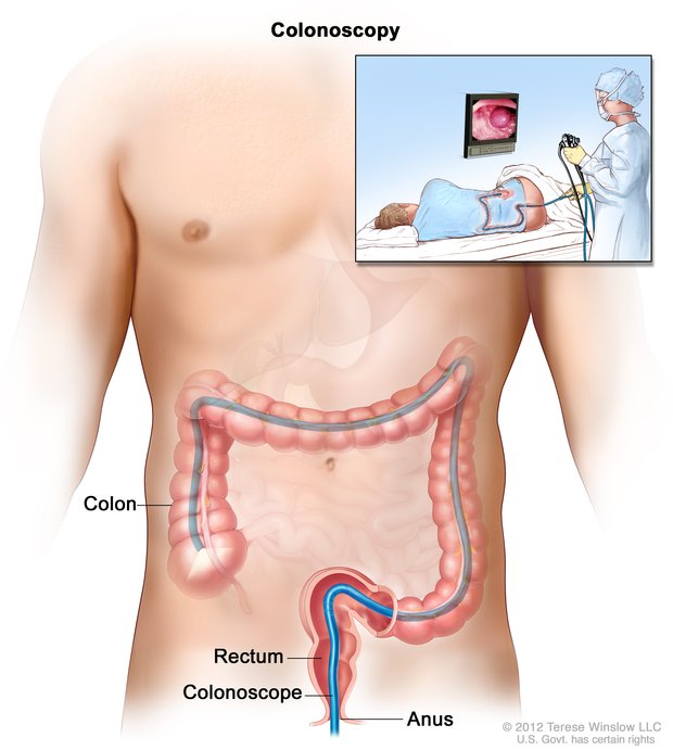 Colonoscopy in dubai